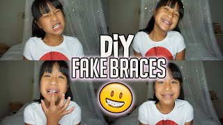 DIY FAKE BRACES SUPER EASY TRENDY ON TIKTOK [upl. by Eskill]