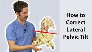 Lateral Pelvic Tilt Correction 4 step guide  Works FAST [upl. by Gunar99]