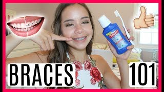 Braces 101 Advice Tips Tricks amp What to Expect 1 year Experience [upl. by Myranda]