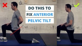 6 Minute Routine to Correct ANTERIOR Pelvic Tilt [upl. by Hogen308]