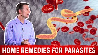 Best Home Remedies for Parasites – Dr Berg [upl. by Rep403]