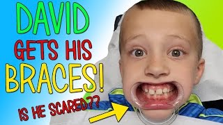 David Gets BRACES [upl. by Kravits]