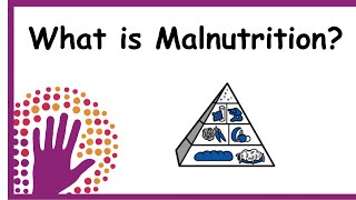 What is Malnutrition [upl. by Lawley448]