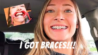 FINALLY GETTING BRACES ON VLOG 2023 [upl. by Corabella]