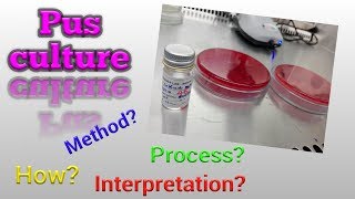 Pus culture test procedure Microbiology [upl. by Verneuil]