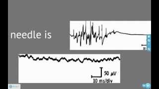 EMG and Action Potentials [upl. by Calvano]