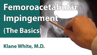 Femoroacetabular Impingement The Basics [upl. by Eznyl]